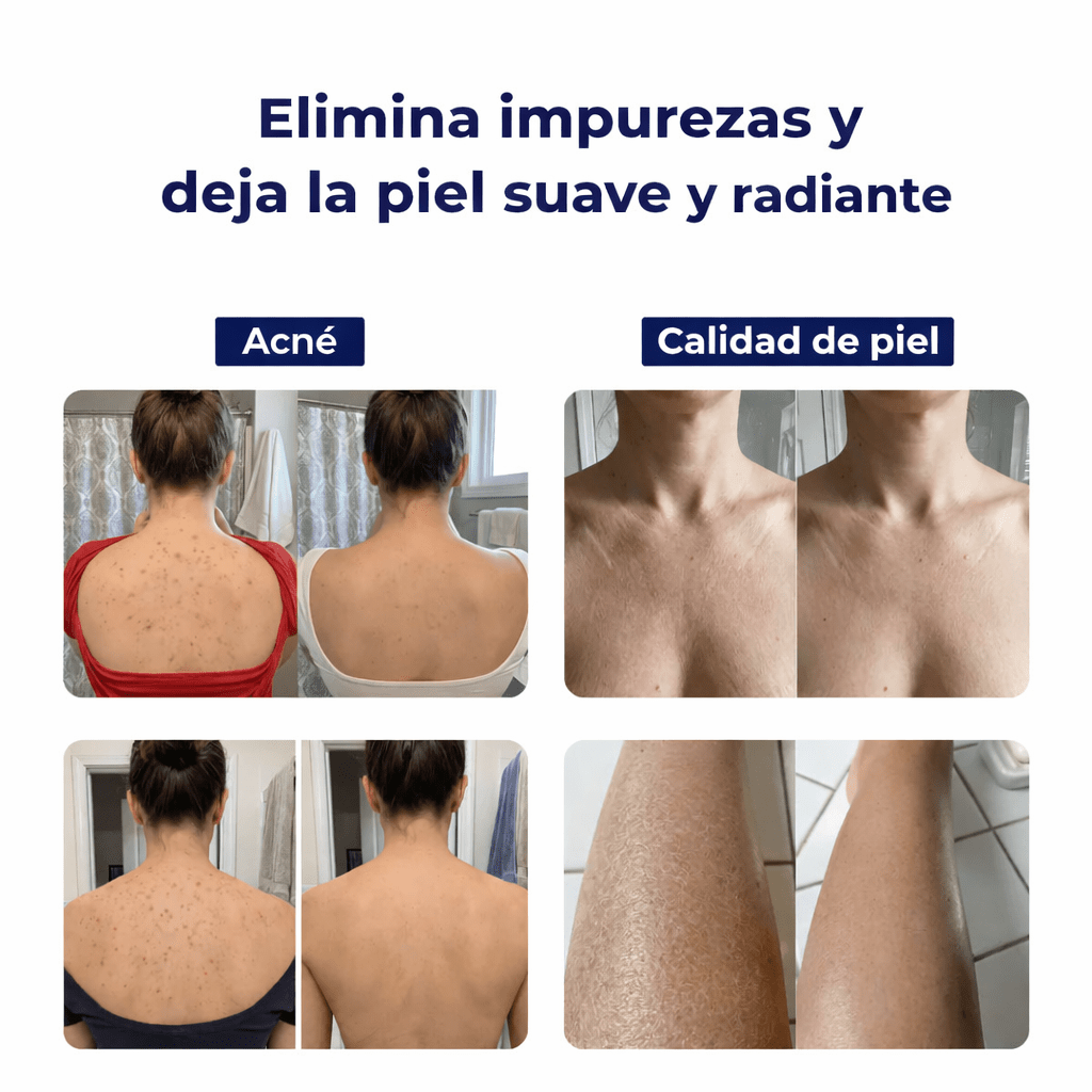 Toalla Exfoliante Antibacteriana para Ducha